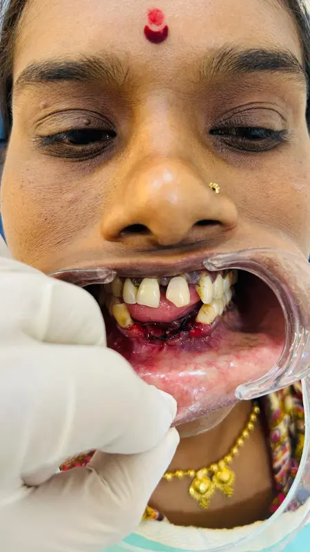 Sterile dental workspace